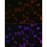 Immunofluorescence - Anti-TCIRG1 Antibody (A91446) - Antibodies.com