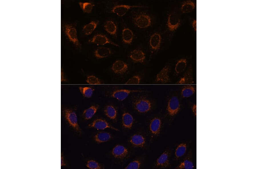 Immunofluorescence - Anti-TCIRG1 Antibody (A91446) - Antibodies.com