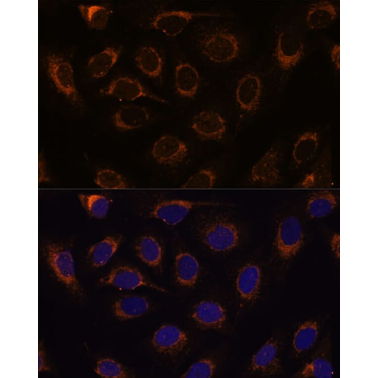 Immunofluorescence - Anti-TCIRG1 Antibody (A91446) - Antibodies.com