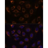 Immunofluorescence - Anti-TCIRG1 Antibody (A91446) - Antibodies.com