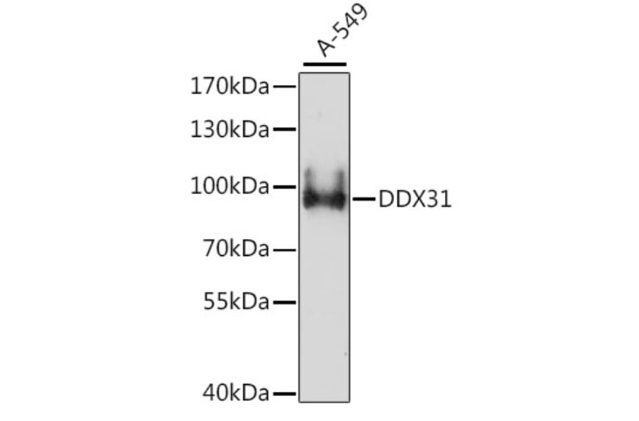 Western Blot - Anti-DDX31 Antibody (A91448) - Antibodies.com