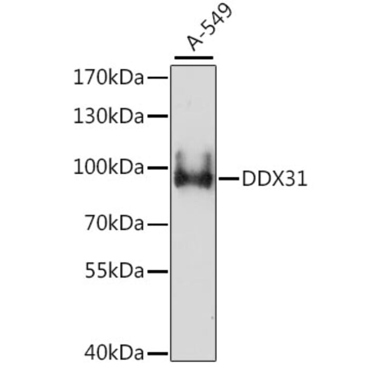 Western Blot - Anti-DDX31 Antibody (A91448) - Antibodies.com
