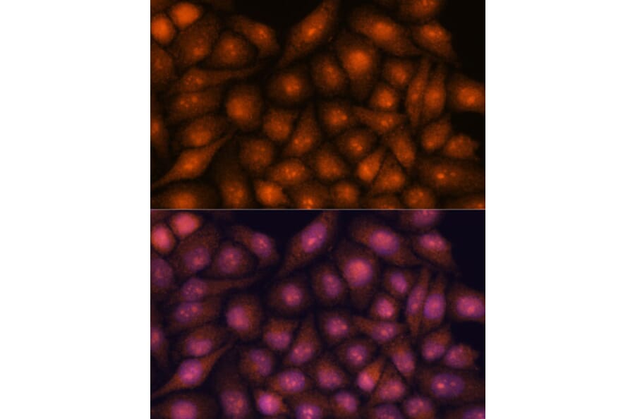 Immunofluorescence - Anti-DDX31 Antibody (A91448) - Antibodies.com