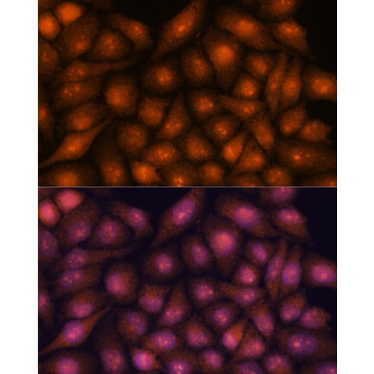 Immunofluorescence - Anti-DDX31 Antibody (A91448) - Antibodies.com