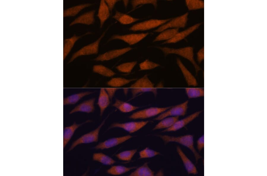 Immunofluorescence - Anti-DDX31 Antibody (A91448) - Antibodies.com