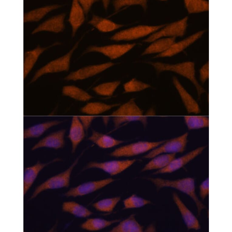 Immunofluorescence - Anti-DDX31 Antibody (A91448) - Antibodies.com