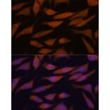 Immunofluorescence - Anti-DDX31 Antibody (A91448) - Antibodies.com