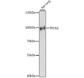 Western Blot - Anti-TPCN1 Antibody (A91449) - Antibodies.com
