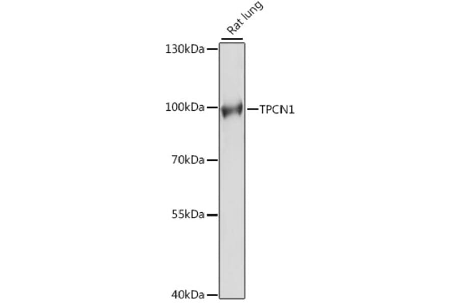 Western Blot - Anti-TPCN1 Antibody (A91449) - Antibodies.com
