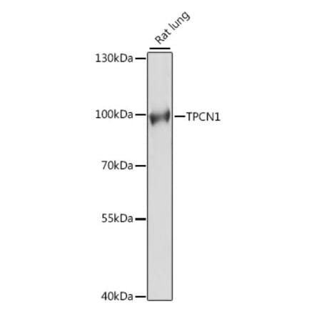 Western Blot - Anti-TPCN1 Antibody (A91449) - Antibodies.com