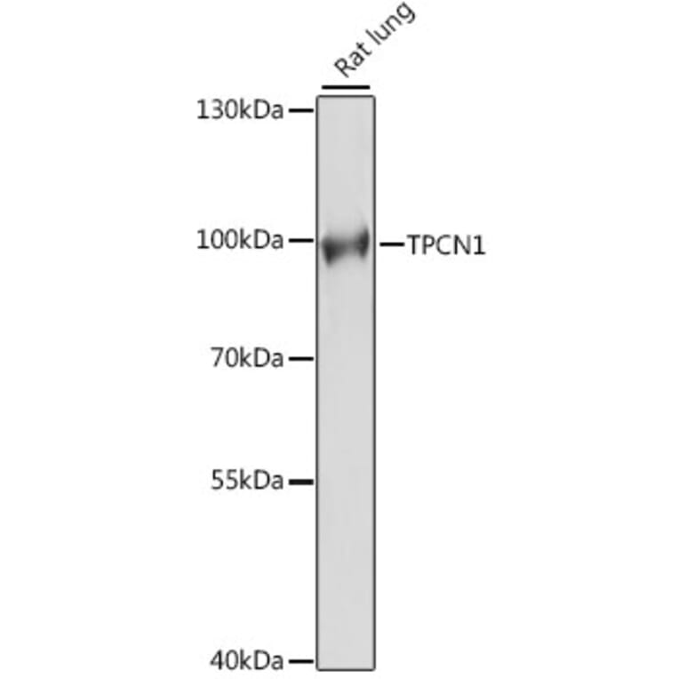 Western Blot - Anti-TPCN1 Antibody (A91449) - Antibodies.com