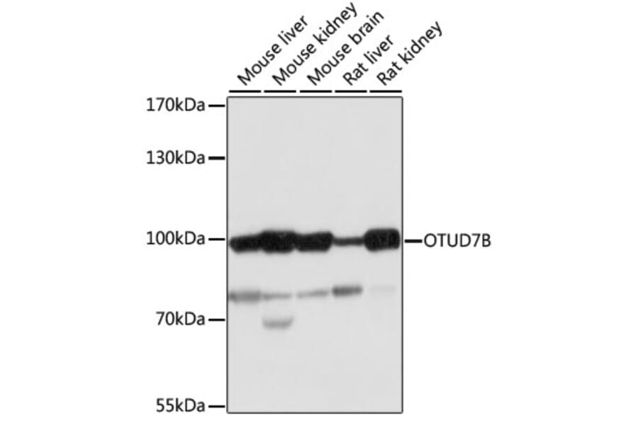 Western Blot - Anti-Cezanne Antibody (A91450) - Antibodies.com