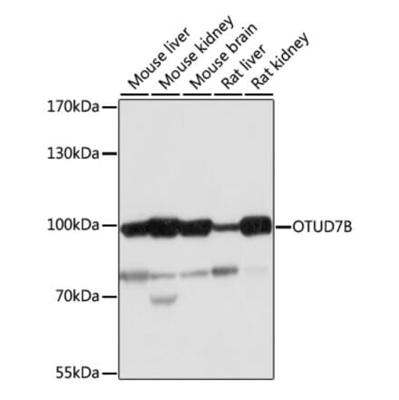 Western Blot - Anti-Cezanne Antibody (A91450) - Antibodies.com