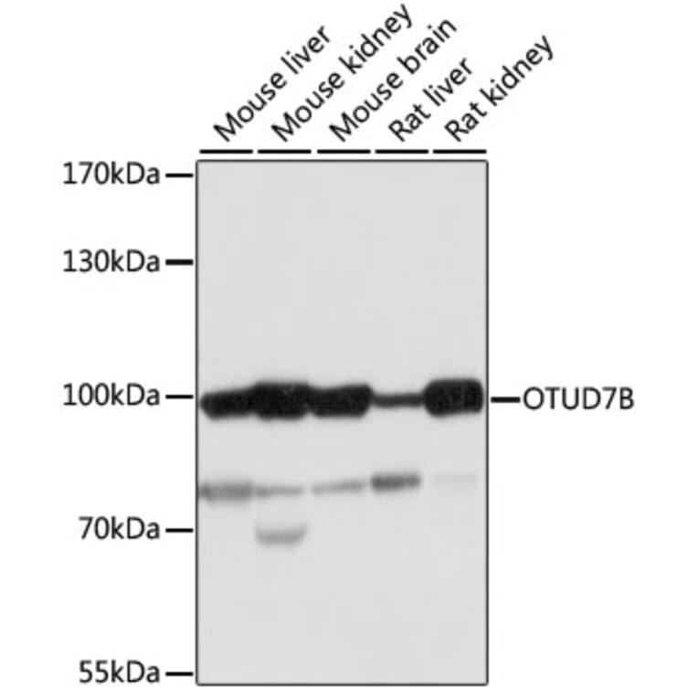 Western Blot - Anti-Cezanne Antibody (A91450) - Antibodies.com