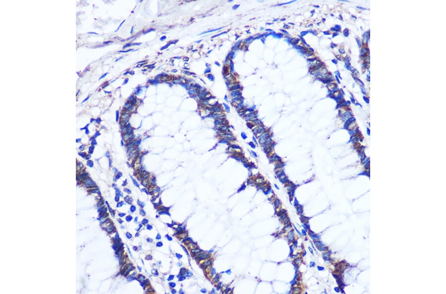 Immunohistochemistry - Anti-Cezanne Antibody (A91450) - Antibodies.com