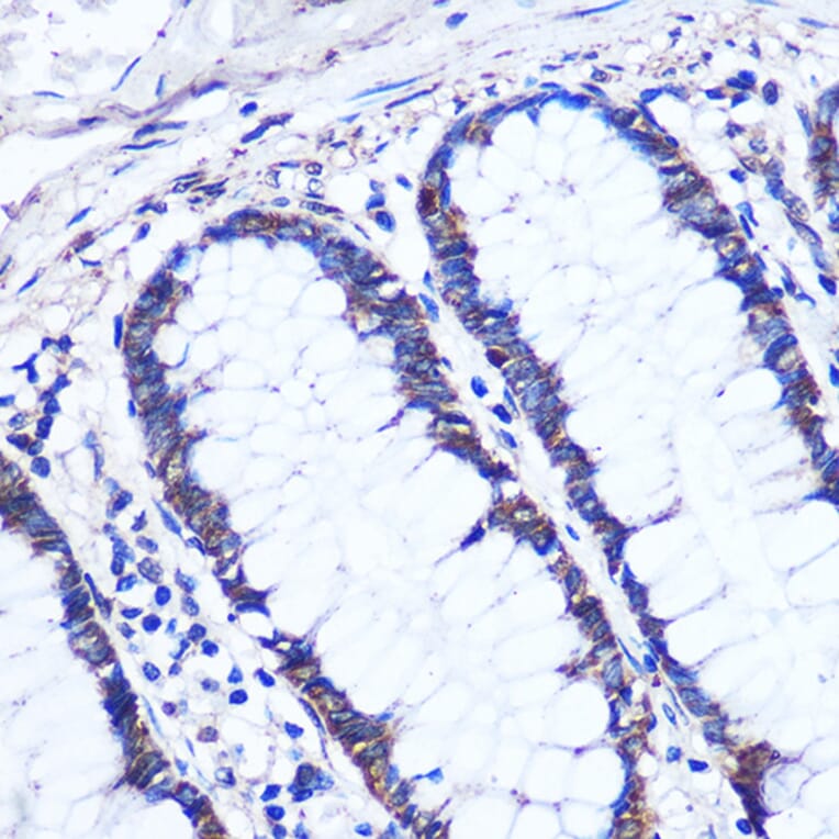 Immunohistochemistry - Anti-Cezanne Antibody (A91450) - Antibodies.com