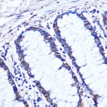 Immunohistochemistry - Anti-Cezanne Antibody (A91450) - Antibodies.com