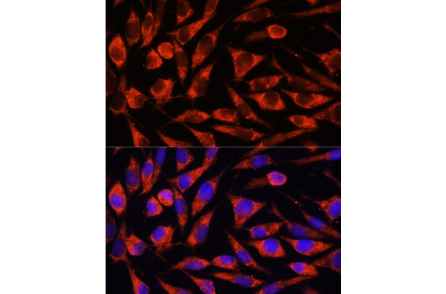 Immunofluorescence - Anti-Cezanne Antibody (A91450) - Antibodies.com