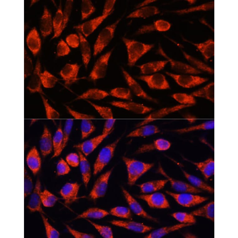 Immunofluorescence - Anti-Cezanne Antibody (A91450) - Antibodies.com