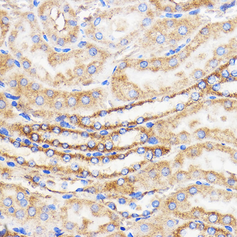 Immunohistochemistry - Anti-Mitofusin 2 Antibody (A91451) - Antibodies.com