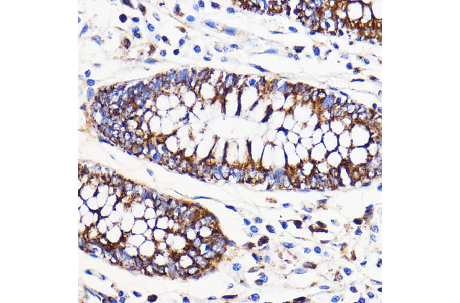 Immunohistochemistry - Anti-Mitofusin 2 Antibody (A91451) - Antibodies.com