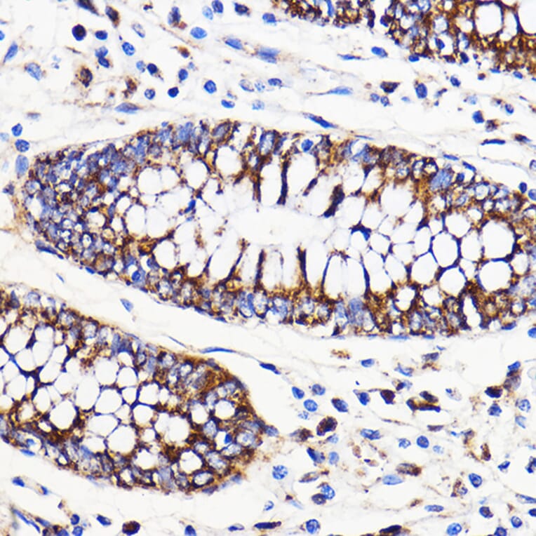Immunohistochemistry - Anti-Mitofusin 2 Antibody (A91451) - Antibodies.com
