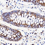 Immunohistochemistry - Anti-Mitofusin 2 Antibody (A91451) - Antibodies.com