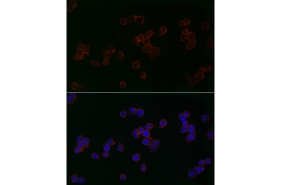 Immunofluorescence - Anti-Mitofusin 2 Antibody (A91451) - Antibodies.com