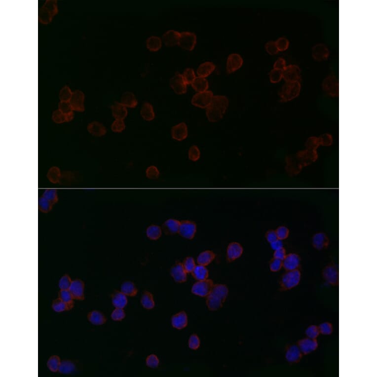 Immunofluorescence - Anti-Mitofusin 2 Antibody (A91451) - Antibodies.com