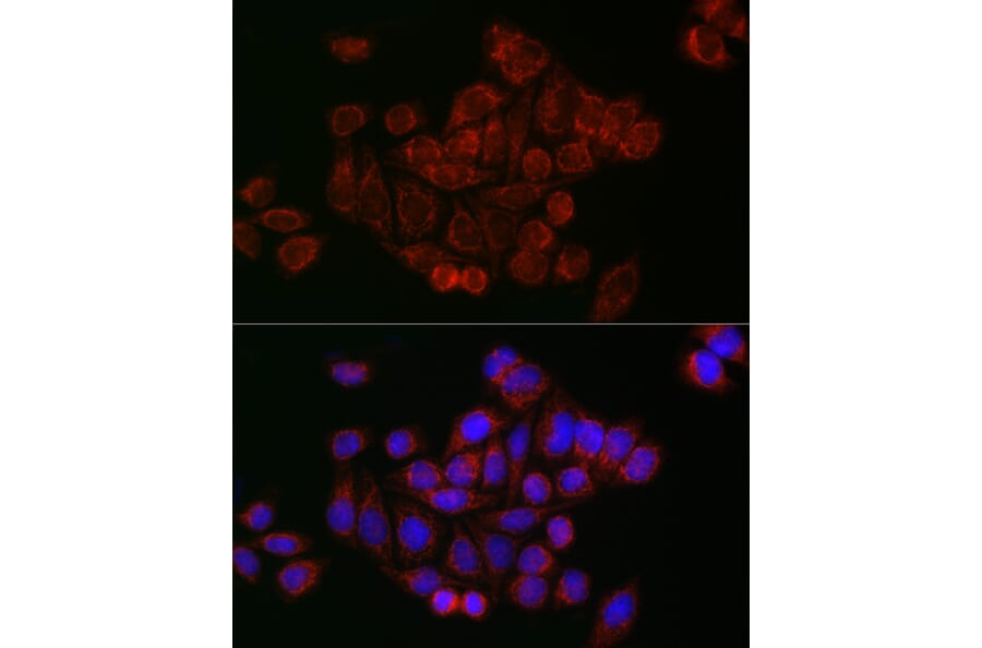 Immunofluorescence - Anti-Mitofusin 2 Antibody (A91451) - Antibodies.com