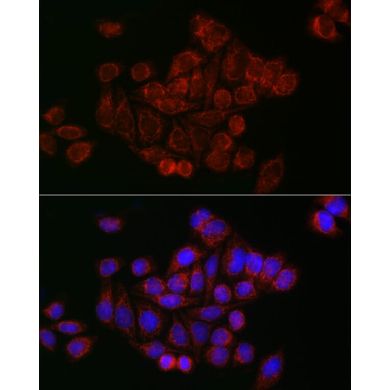 Immunofluorescence - Anti-Mitofusin 2 Antibody (A91451) - Antibodies.com