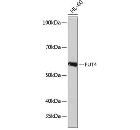 Western Blot - Anti-FUT4 Antibody (A91452) - Antibodies.com