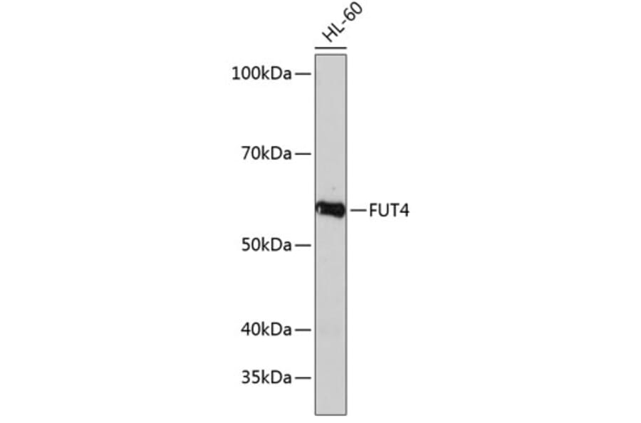 Western Blot - Anti-FUT4 Antibody (A91452) - Antibodies.com