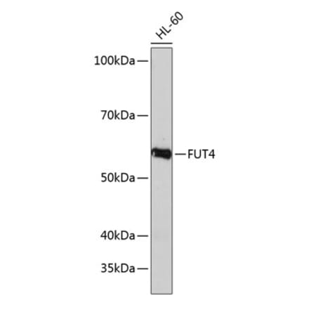 Western Blot - Anti-FUT4 Antibody (A91452) - Antibodies.com