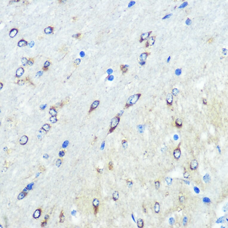 Immunohistochemistry - Anti-FUT4 Antibody (A91452) - Antibodies.com