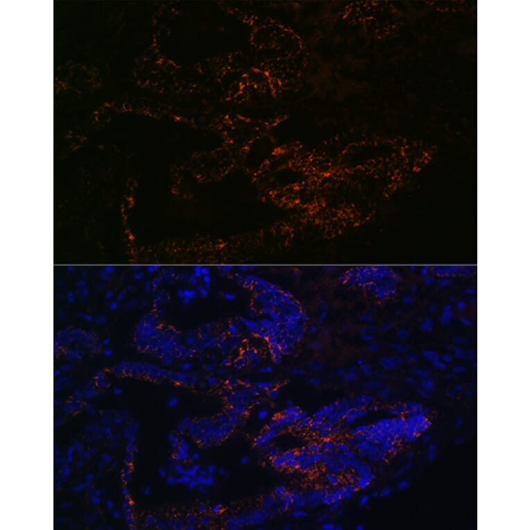 Immunofluorescence - Anti-FUT4 Antibody (A91452) - Antibodies.com