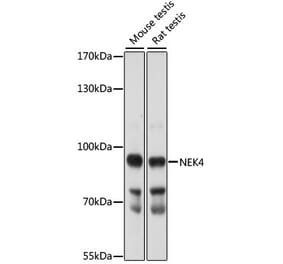Western Blot - Anti-NEK4 Antibody (A91455) - Antibodies.com