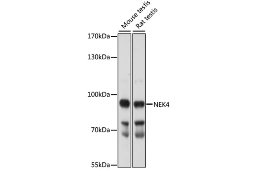 Western Blot - Anti-NEK4 Antibody (A91455) - Antibodies.com