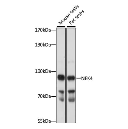 Western Blot - Anti-NEK4 Antibody (A91455) - Antibodies.com