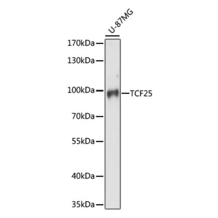 Western Blot - Anti-TCF-25 Antibody (A91457) - Antibodies.com