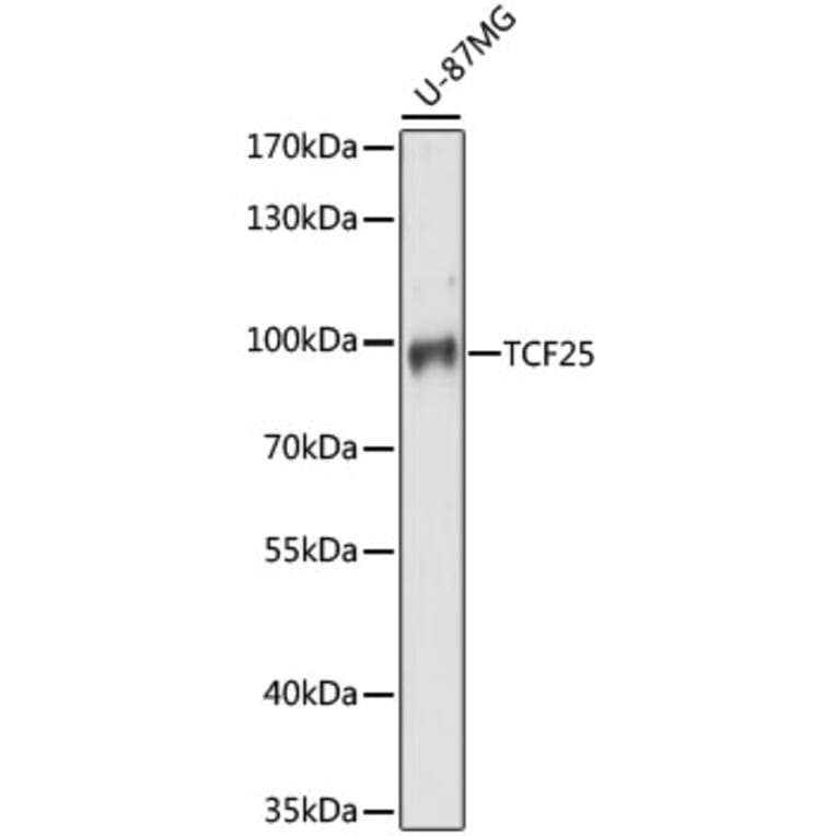 Western Blot - Anti-TCF-25 Antibody (A91457) - Antibodies.com