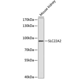 Western Blot - Anti-SLC22A2 Antibody (A91459) - Antibodies.com