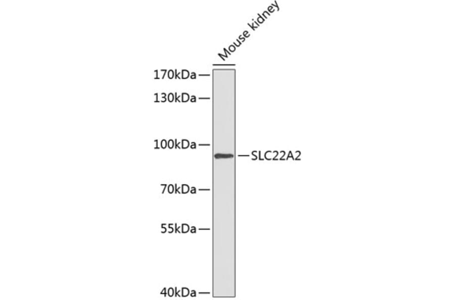 Western Blot - Anti-SLC22A2 Antibody (A91459) - Antibodies.com