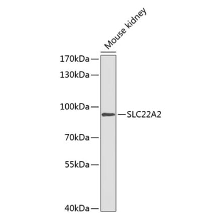 Western Blot - Anti-SLC22A2 Antibody (A91459) - Antibodies.com