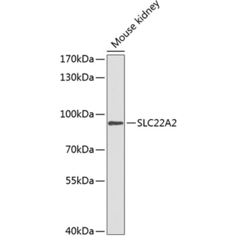 Western Blot - Anti-SLC22A2 Antibody (A91459) - Antibodies.com