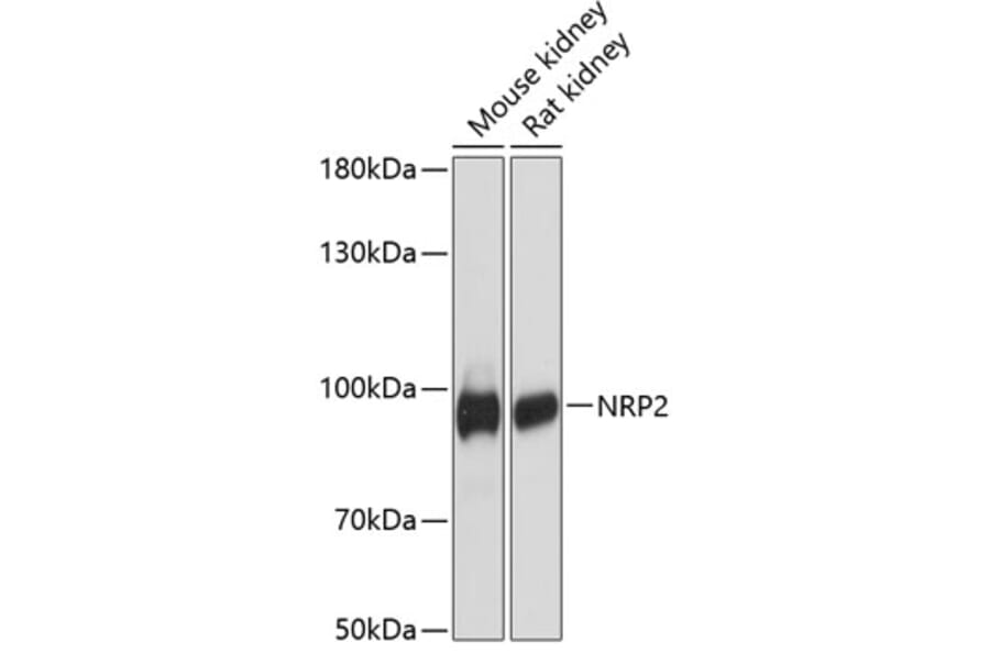 Western Blot - Anti-NRP2 Antibody (A91460) - Antibodies.com