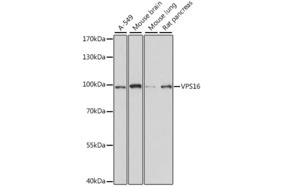 Western Blot - Anti-VPS16 Antibody (A91461) - Antibodies.com
