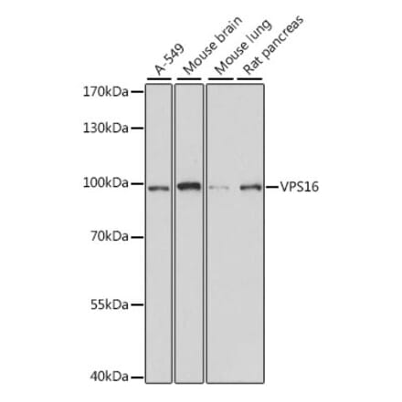 Western Blot - Anti-VPS16 Antibody (A91461) - Antibodies.com