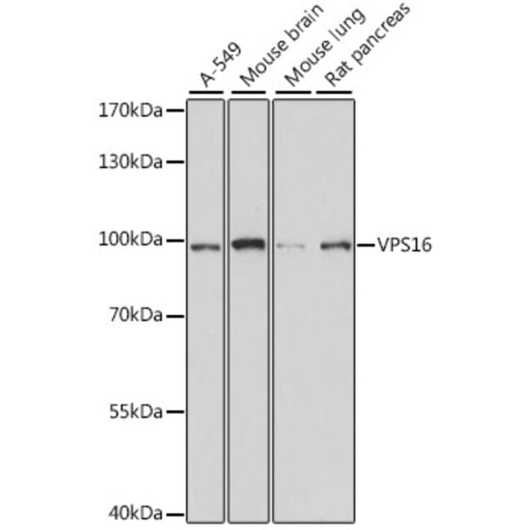 Western Blot - Anti-VPS16 Antibody (A91461) - Antibodies.com