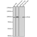 Western Blot - Anti-VPS16 Antibody (A91461) - Antibodies.com
